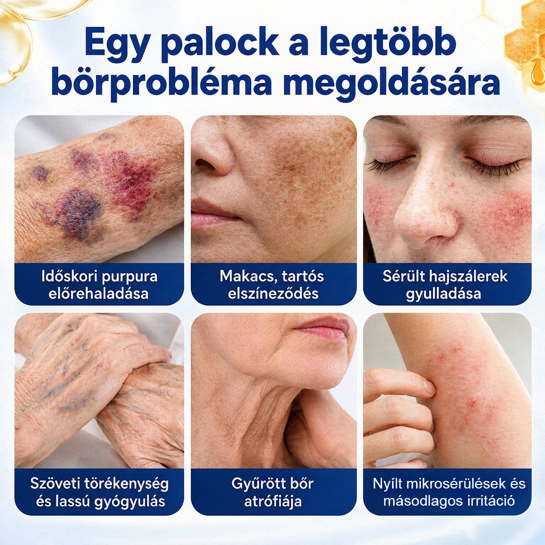 CleraNaure® VenoRescue Méhméreg Zúzódás- és Bőrregeneráló Spray