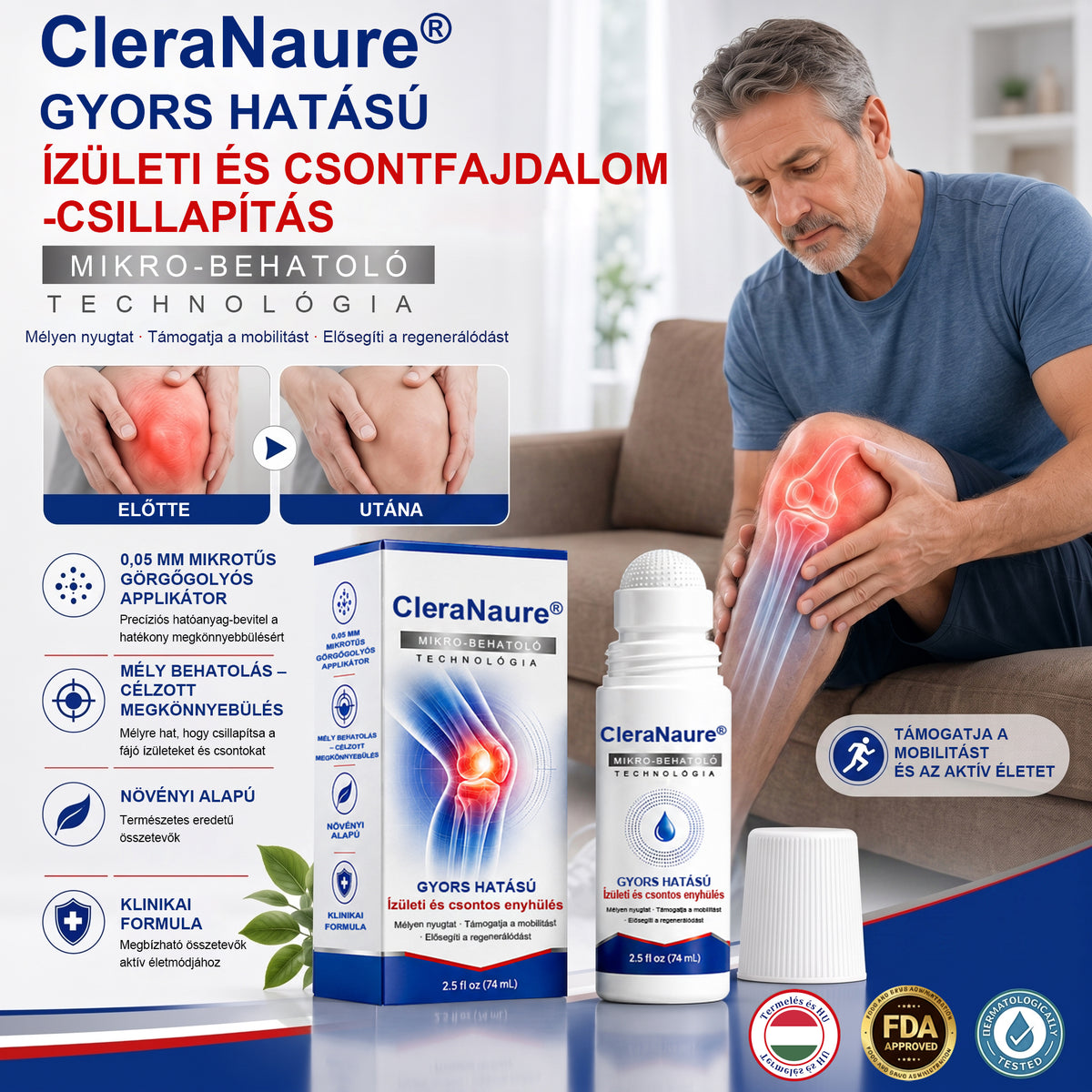 🪐CleraNaure® ✅ 0,05 mm-es mikro-tűs csont- és ízületi görgő 🌈