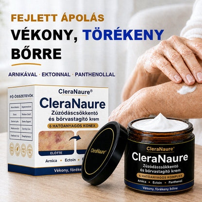 CleraNaure® DermFortify – Fejlett véraláfutás-halványító és bőrvastagító krém vékony, törékeny bőrre