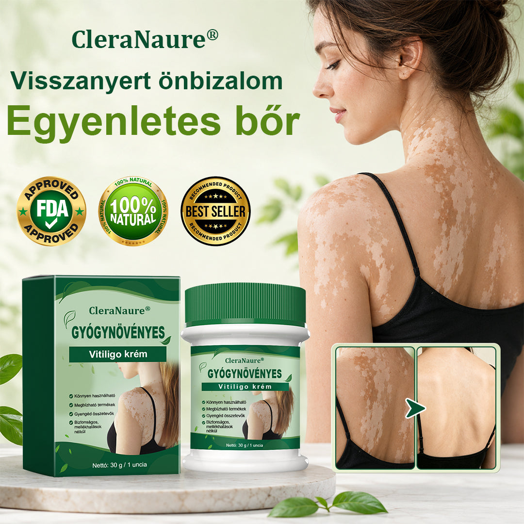 CleraNaure® Növényi Vitiligo Krém