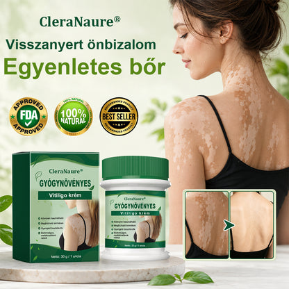CleraNaure® Növényi Vitiligo Krém