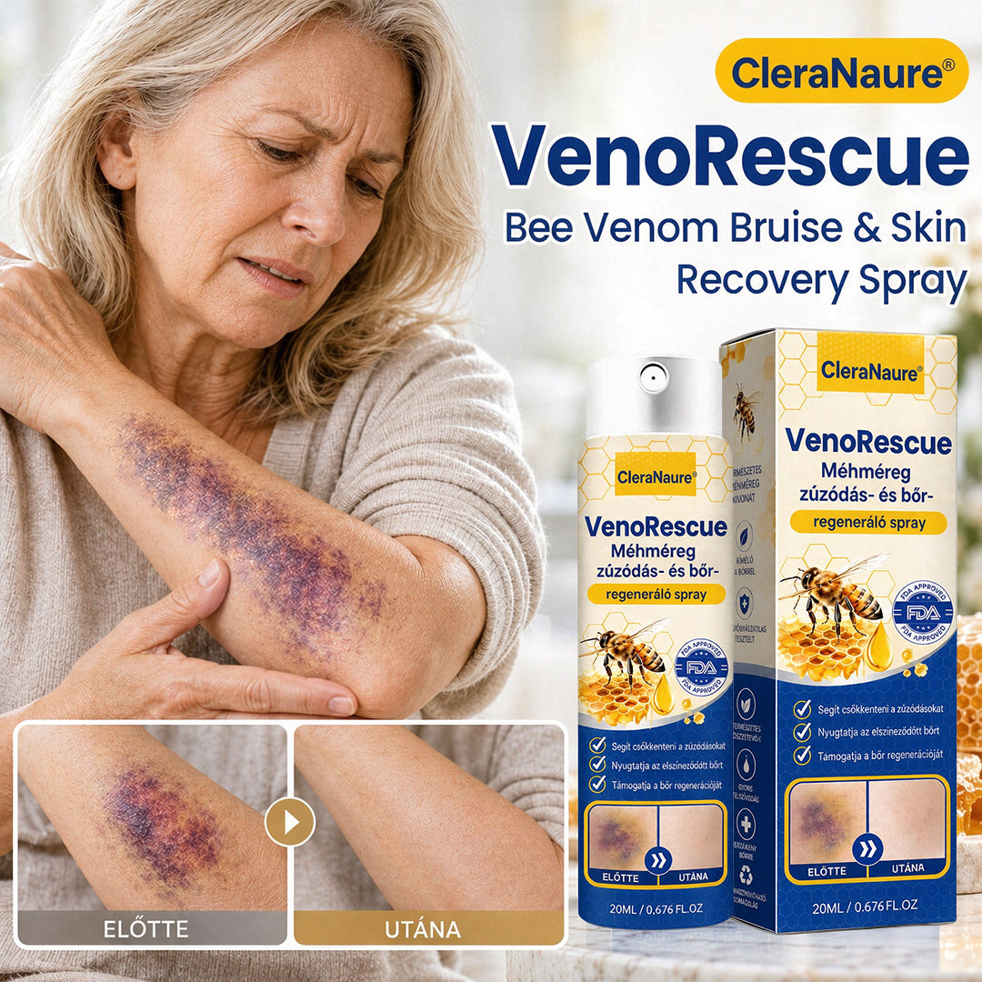 ✨CleraNaure® VenoRescue Méhméreg Zúzódás- és Bőrregeneráló Spray