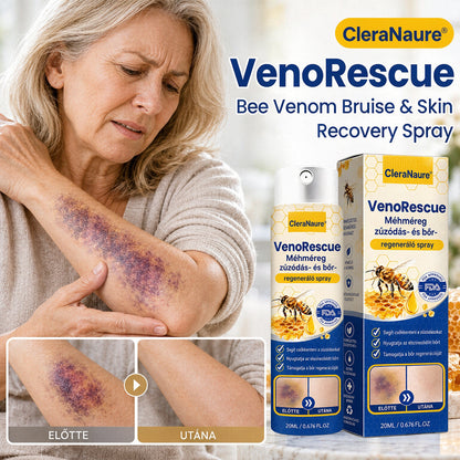 ✨CleraNaure® VenoRescue Méhméreg Zúzódás- és Bőrregeneráló Spray