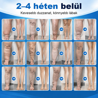 🥇CleraNaure® LightLeg Expert Mikrokeringés Krém