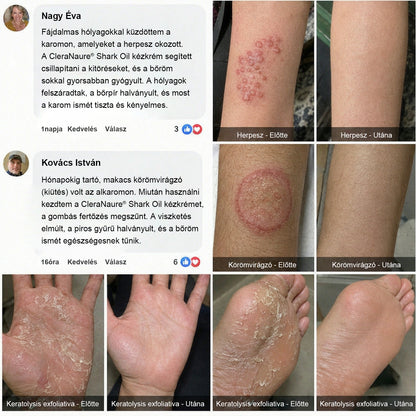CleraNaure® Cápaolajos Kézápoló Krém