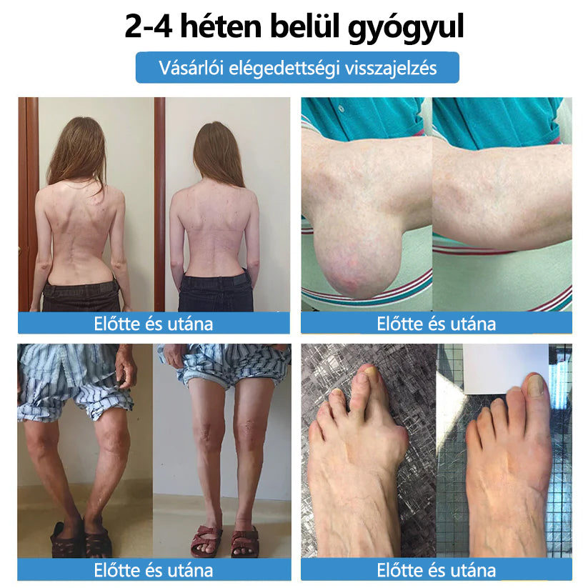 🥇ClearaNature® Nano-tűs közös tapasz