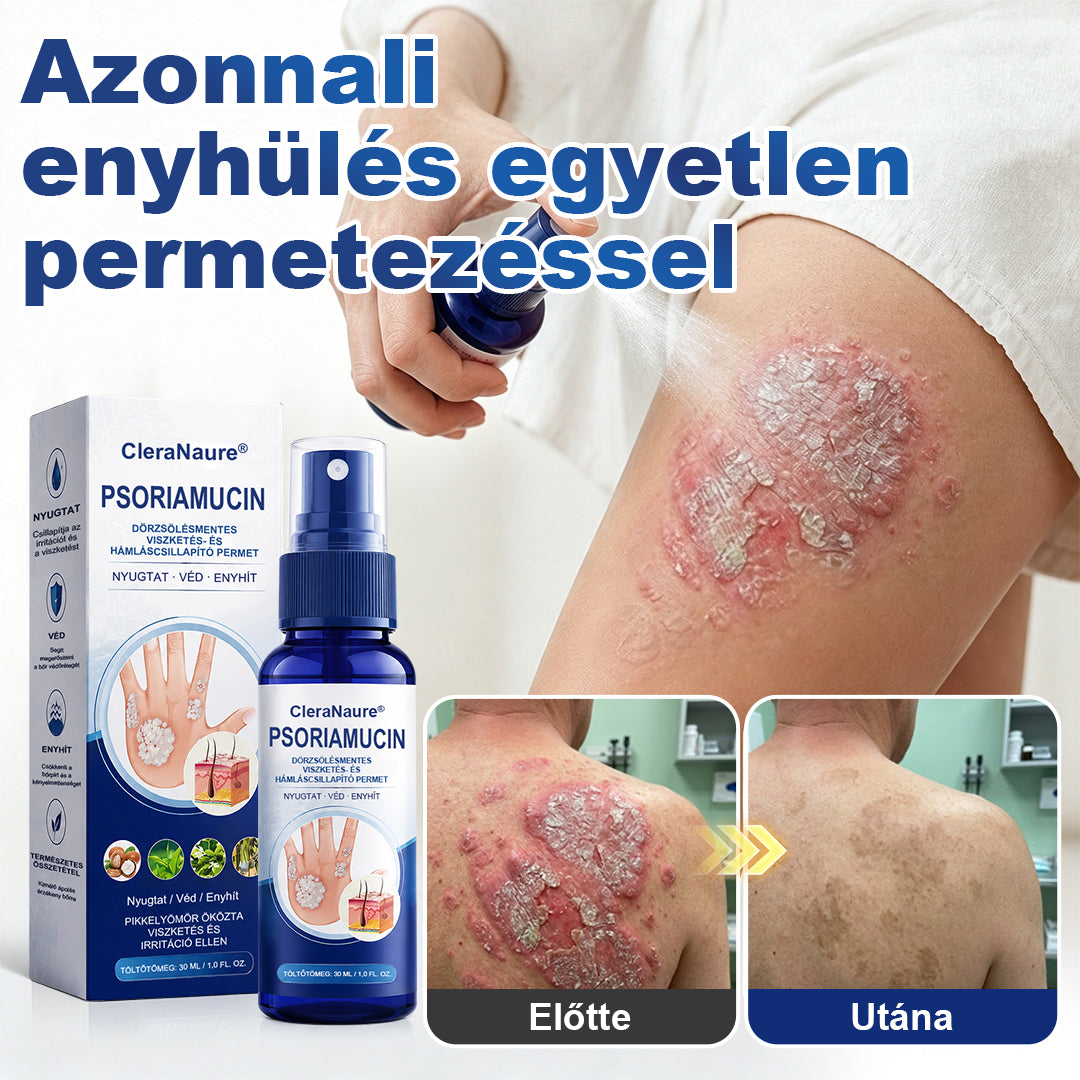 🥇CleraNaure® PsoriaMucin Dörzsölésmentes Viszketés- és Pikkelyenyhítő Permet