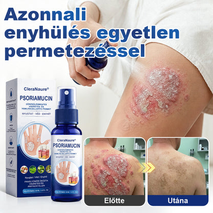 🥇CleraNaure® PsoriaMucin Dörzsölésmentes Viszketés- és Pikkelyenyhítő Permet