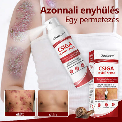 ✨CleraNature® Bálnazsír Spray Viszkető, Hámló Psoriasisra Hajlamos Bőrre