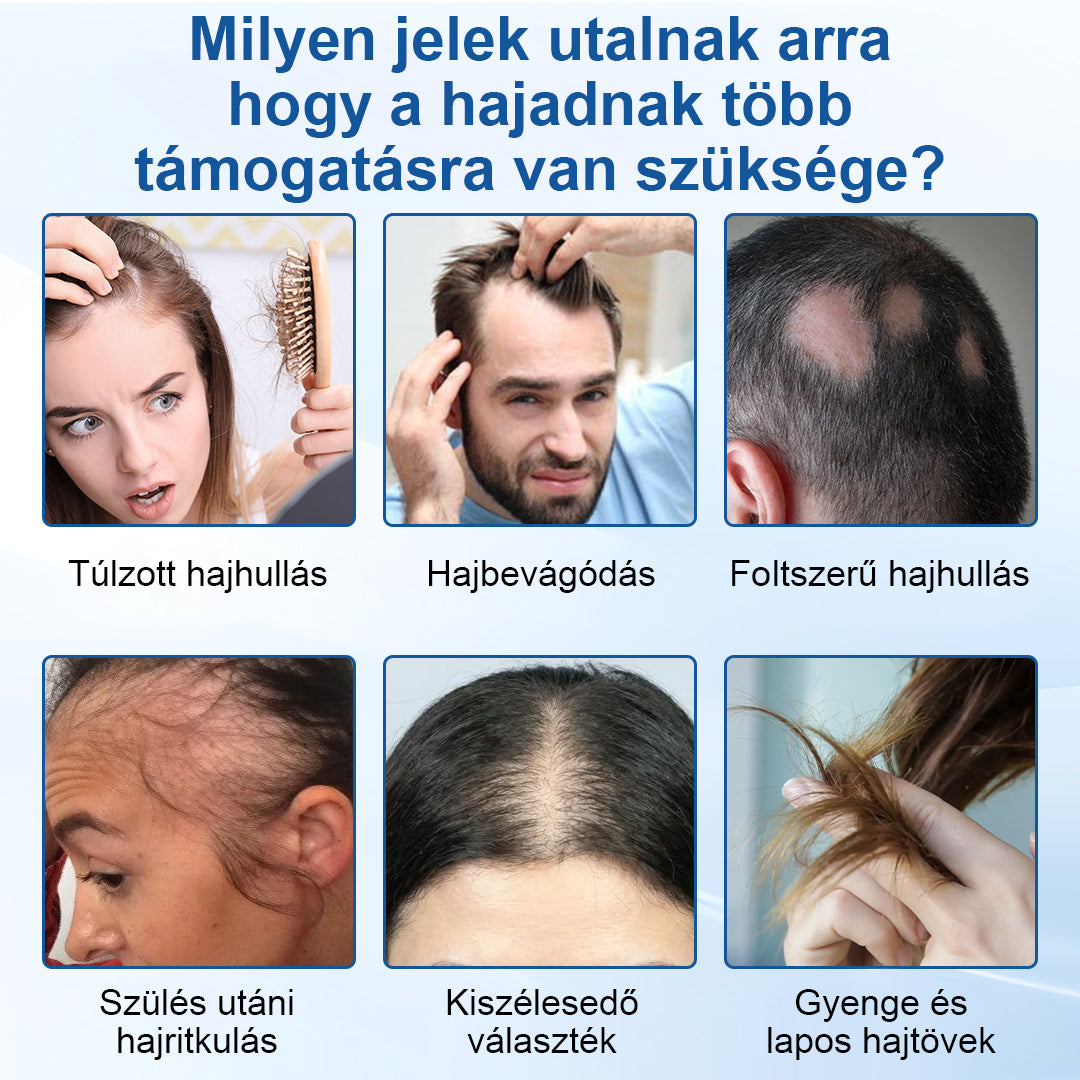 🥇CleraNaure® RootVive Hajnövesztő Fejbőr Szérum Golyós Applikátorral