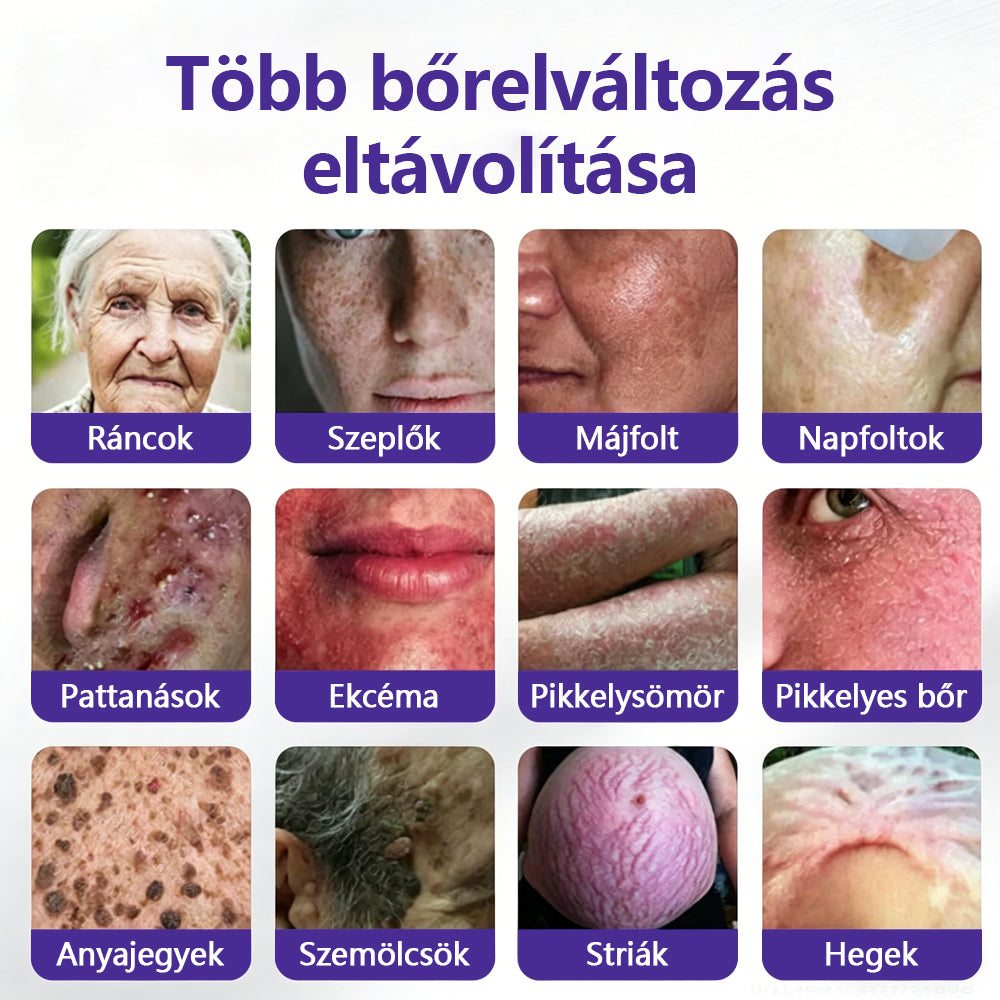 👩🏻‍⚕️COLTURE® szemölcs- és anyajegytávolító mikrotűs tapasz-🌿