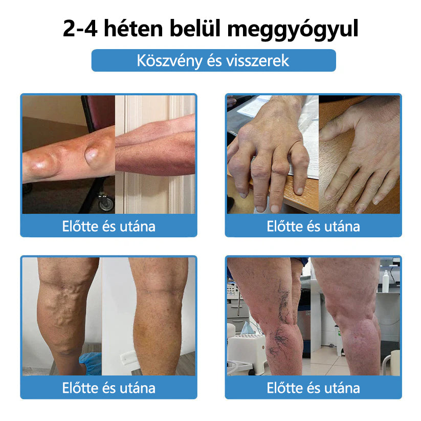 🥇ClearaNature® Nano-tűs közös tapasz