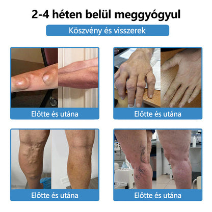 🥇ClearaNature® Nano-tűs közös tapasz