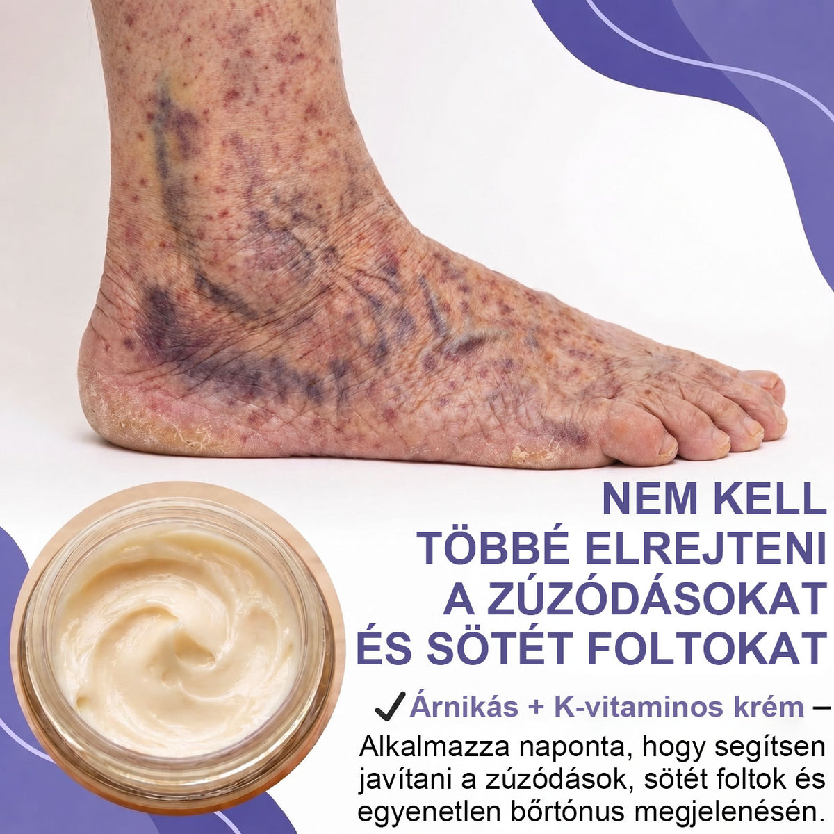 🫧100K+ ELADOTT PÉLDÁNY 🔥 CleraNaure® Sötétfolt- és Zúzódásregeneráló Krém