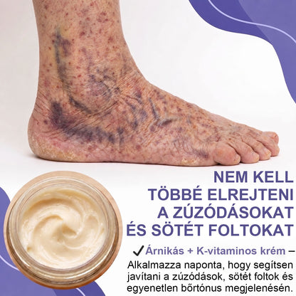 🫧100K+ ELADOTT PÉLDÁNY 🔥 CleraNaure® Sötétfolt- és Zúzódásregeneráló Krém
