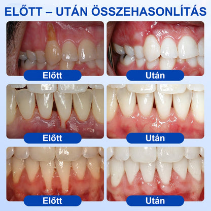🍀CleraNaure® GumRevive – Fogágy-helyreállító Gél✨