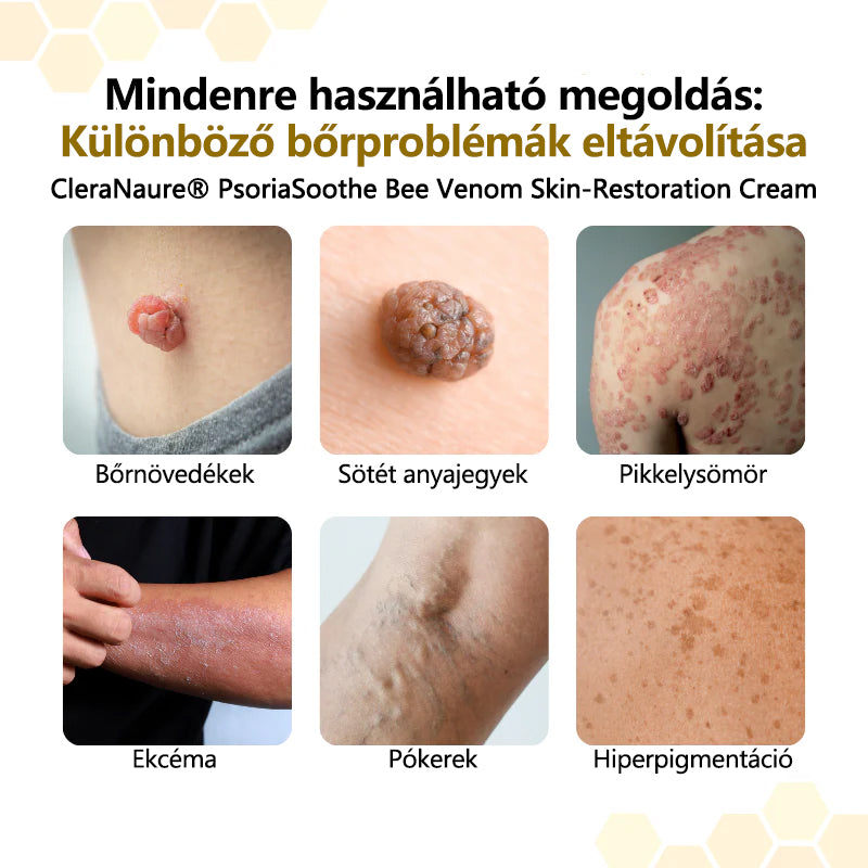 ⭐CleraNaure® PsoriaSoothe Méhméreg Bőrregeneráló Krém
