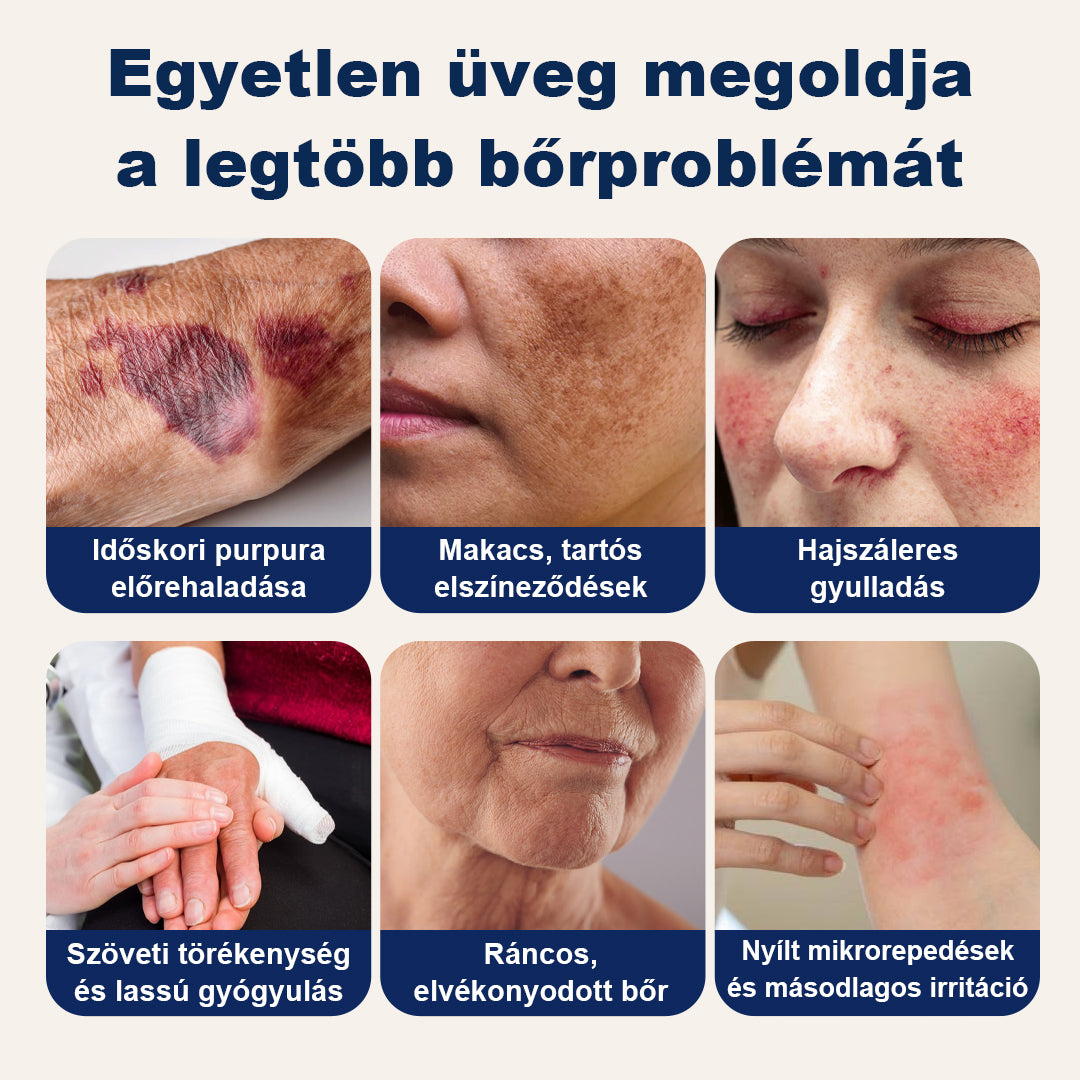 CleraNaure® DermFortify – Fejlett véraláfutás-halványító és bőrvastagító krém vékony, törékeny bőrre