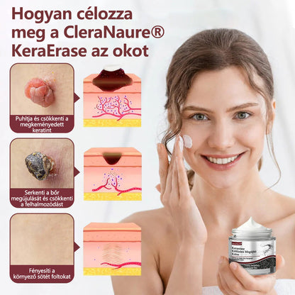 ⭐CleraNaure® KeraErase - Kettős hatású bőrfiatalító krém