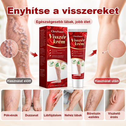 🥇CleraNaure® visszérkezelő krém