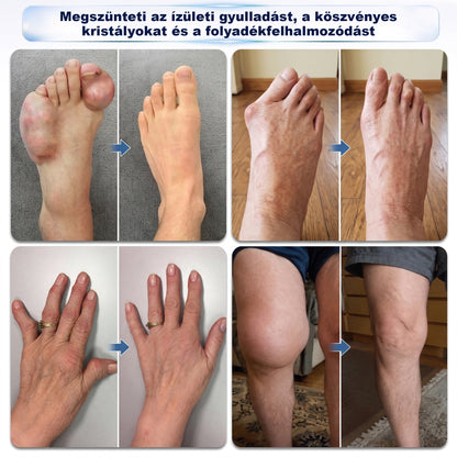 🪐CleraNaure® ✅ 0,05 mm-es mikro-tűs csont- és ízületi görgő 🌈
