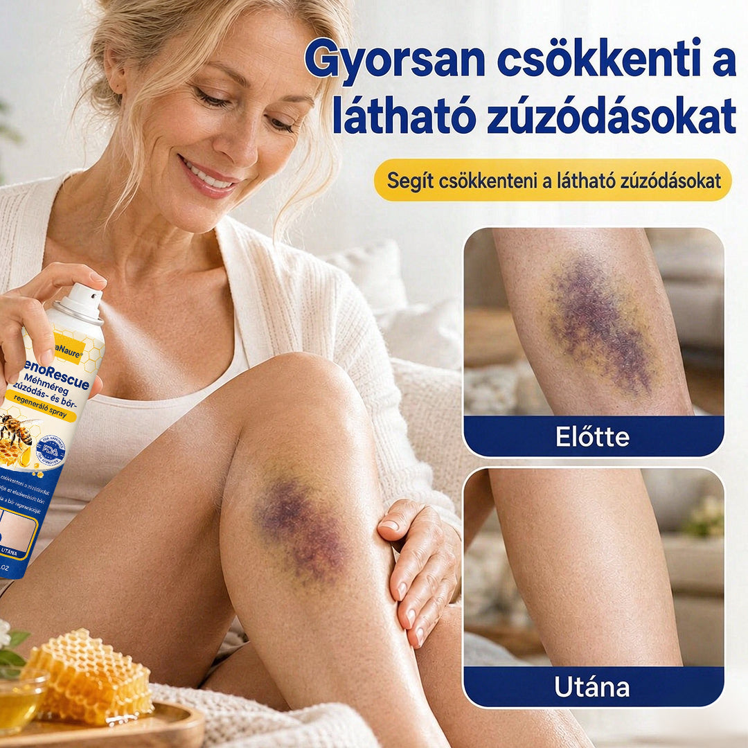 ✨CleraNaure® VenoRescue Méhméreg Zúzódás- és Bőrregeneráló Spray