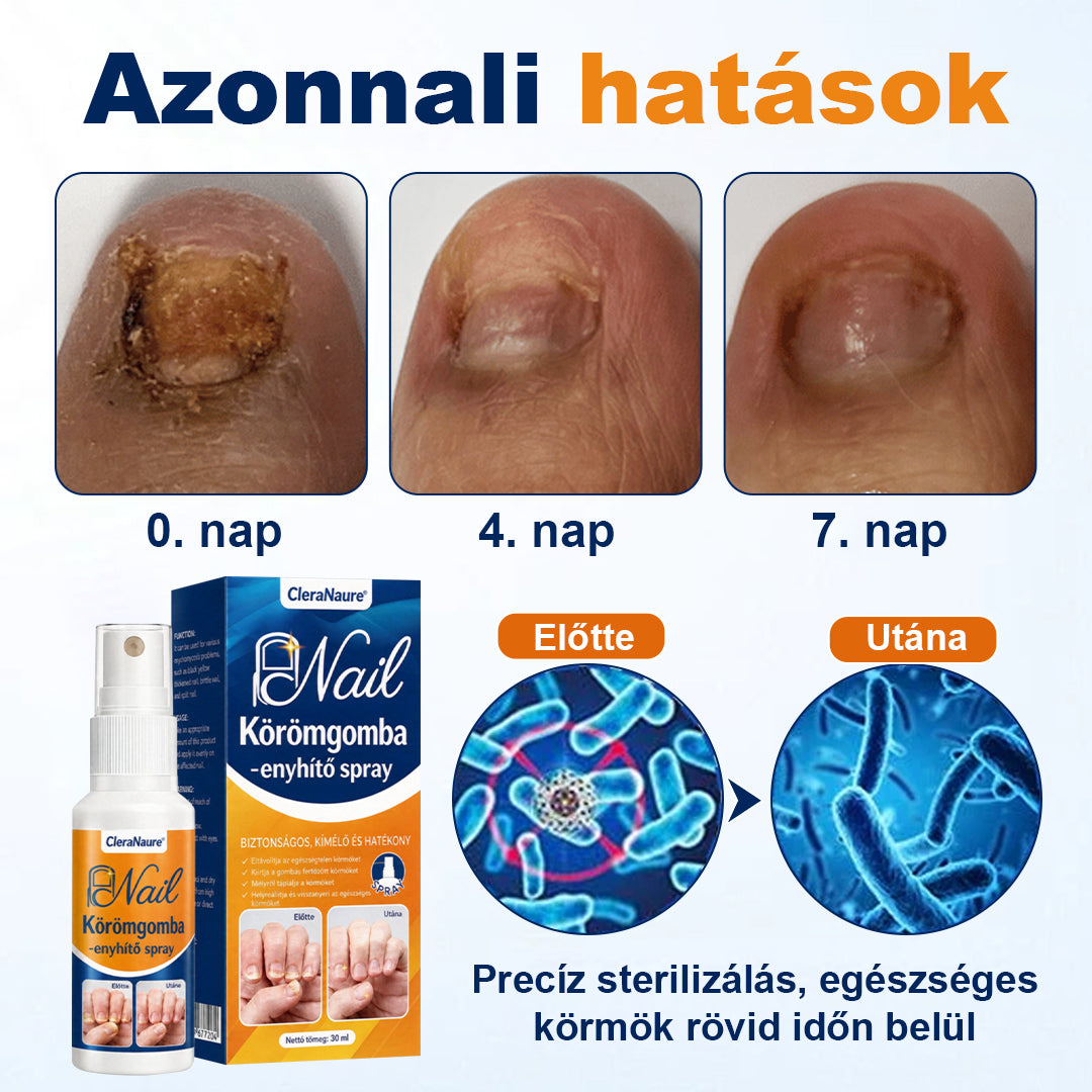 🛡️CleraNaure® körömgomba-ellenes spray