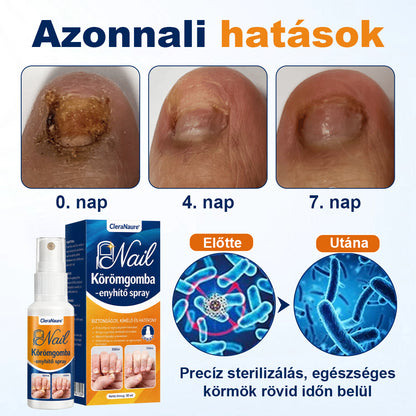 🛡️CleraNaure® körömgomba-ellenes spray