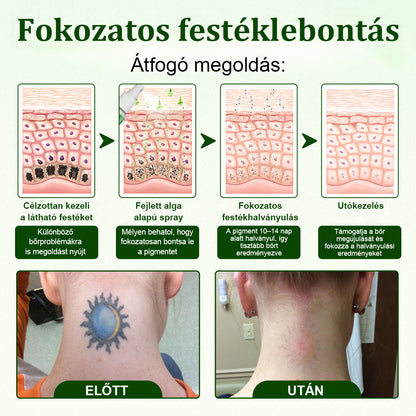🛡️CleraNaure® Tiszta Algás Festékeltávolító Támogató Spray 🌿 — Búcsúzz el a régi tetoválópigmentektől 💚, Halványítsd a makacs festéket ✨, Helyreállítja és kisimítja a kezelt bőrt 💧, Lézermentes ✅, Próbáld ki most! 🔥