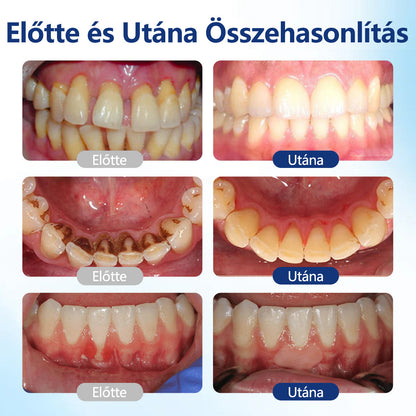 ✨CleraNaure® BeeTakt Szájápoló Javító Oldat