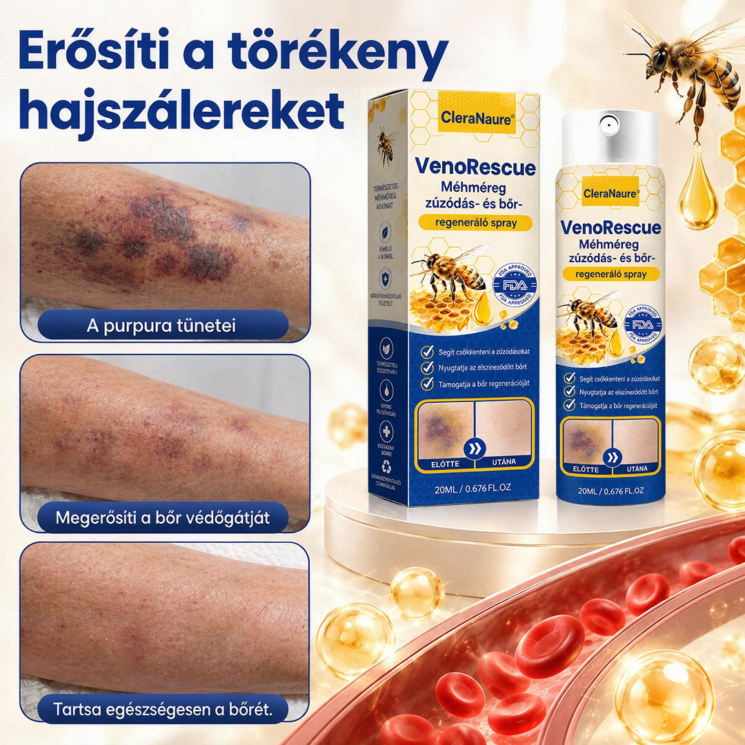 ✨CleraNaure® VenoRescue Méhméreg Zúzódás- és Bőrregeneráló Spray