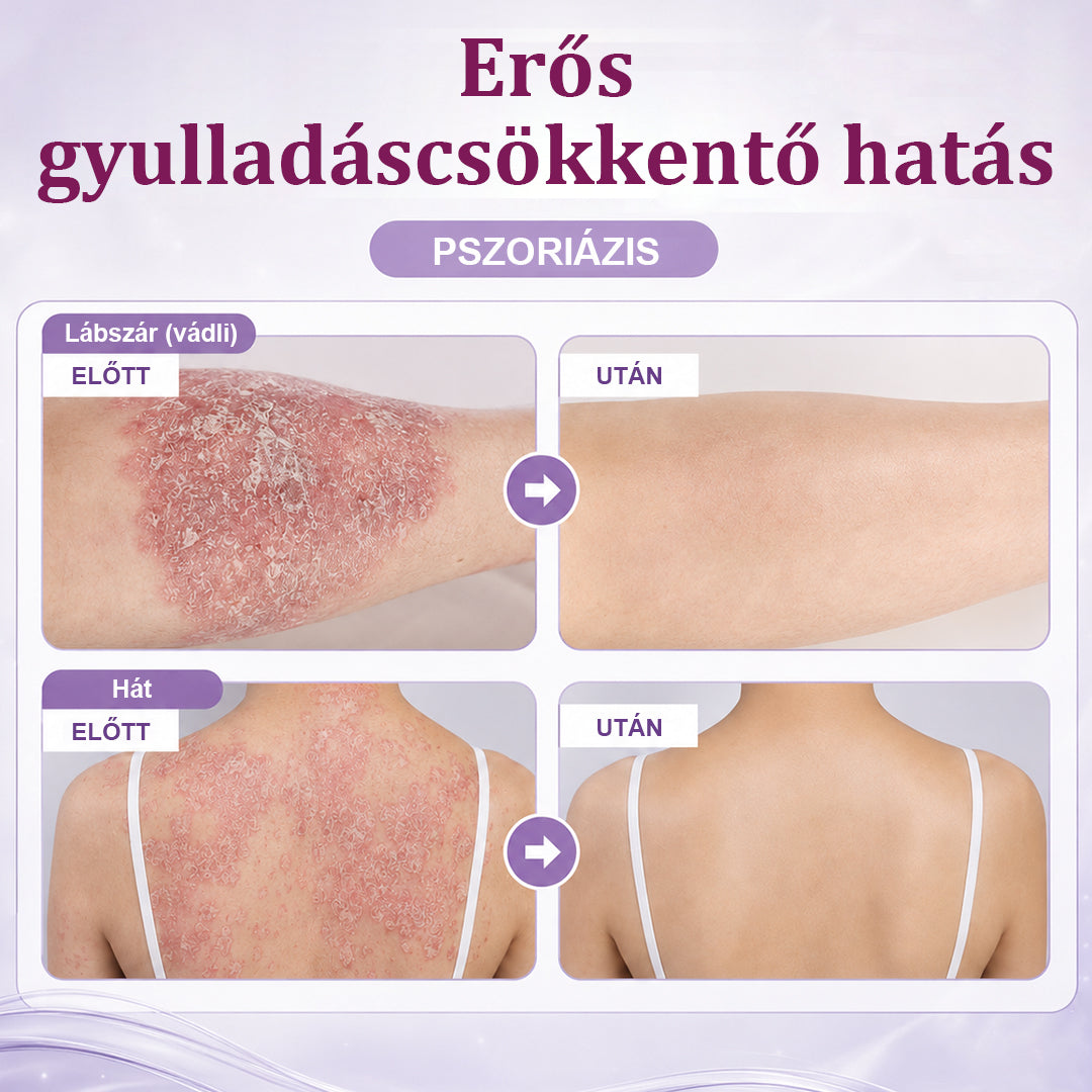 💎CleraNaure® DermaBloom Bőrregeneráló Krém