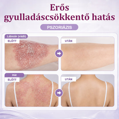 💎CleraNaure® DermaBloom Bőrregeneráló Krém