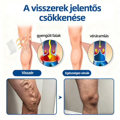 🇭🇺𝐇𝐞𝐚𝐥𝐫𝐢𝐳𝐞® 👩‍⚕️VeinTarget mikrotűs tapasz⚡☑️Azonnali enyhülés hosszú távú eredmények-🔥