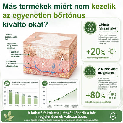 CleraNaure® Növényi Vitiligo Krém