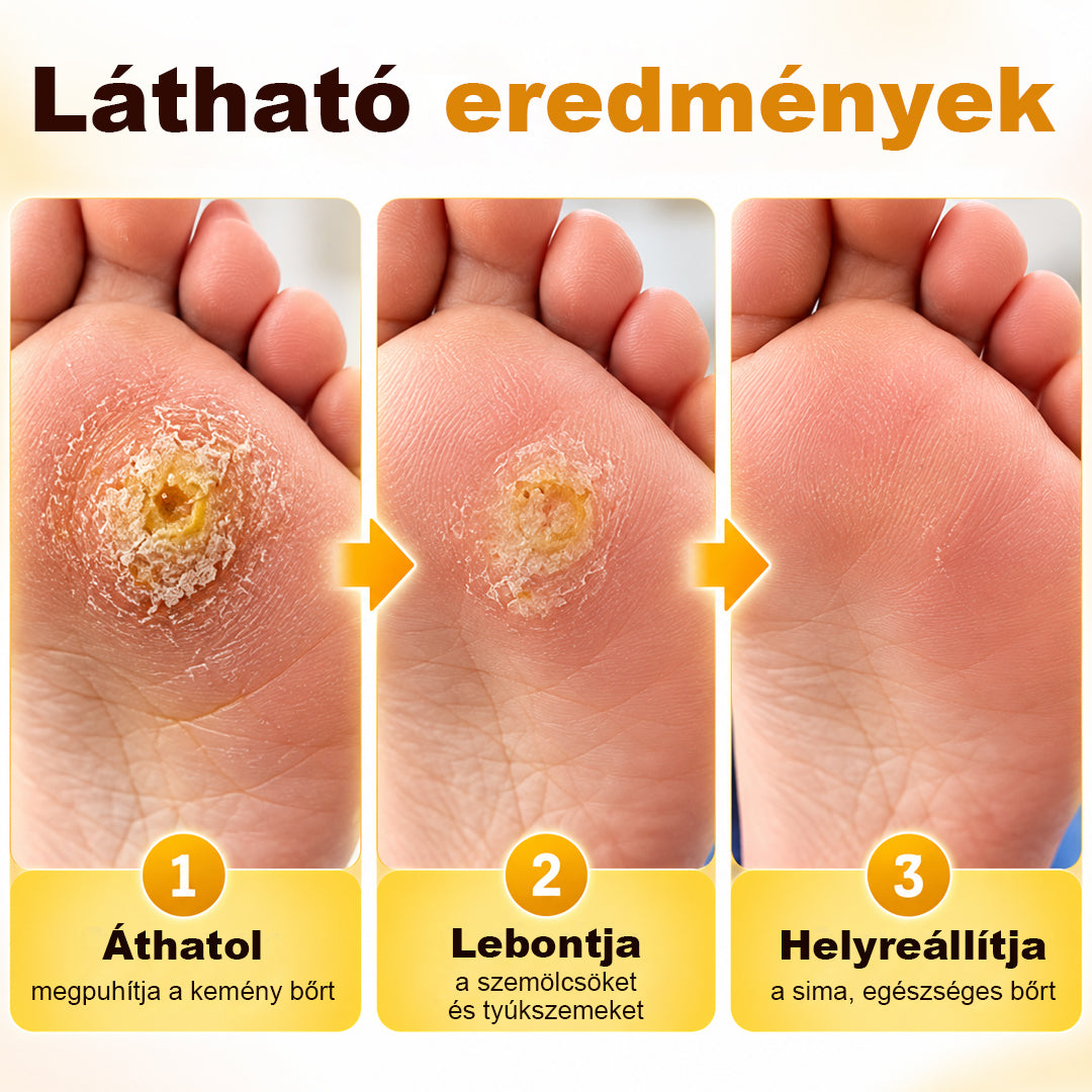 💧CleraNaure® BeeClear Szemölcs- és Tyúkszemmegújító Krém