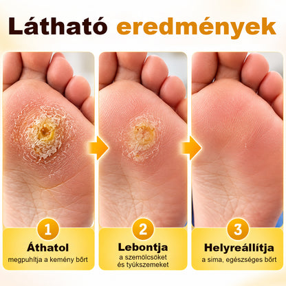 💧CleraNaure® BeeClear Szemölcs- és Tyúkszemmegújító Krém