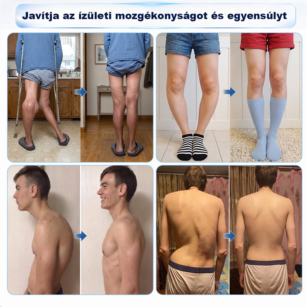 🪐CleraNaure® ✅ 0,05 mm-es mikro-tűs csont- és ízületi görgő 🌈