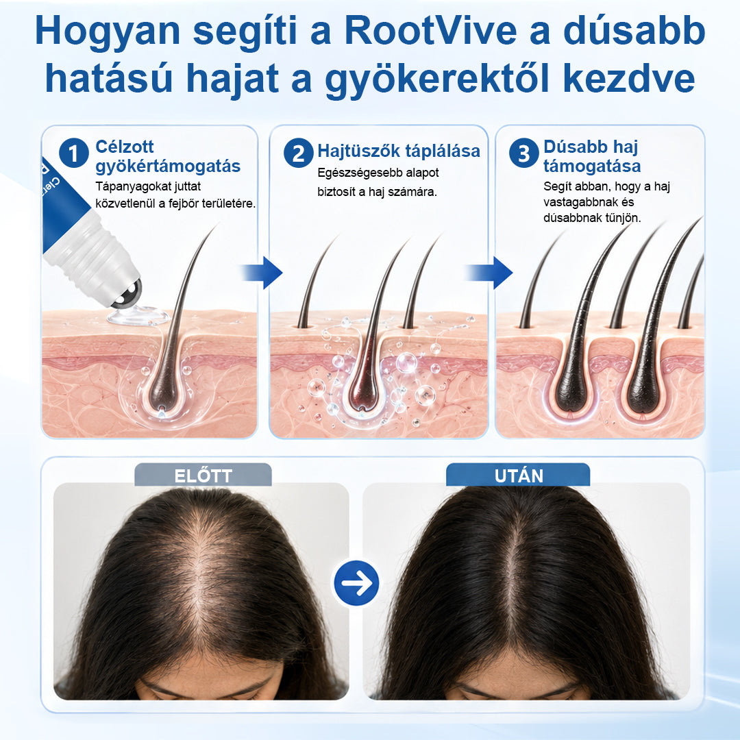 🥇CleraNaure® RootVive Hajnövesztő Fejbőr Szérum Golyós Applikátorral