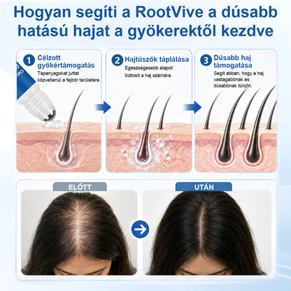 🥇CleraNaure® RootVive Hajnövesztő Fejbőr Szérum Golyós Applikátorral