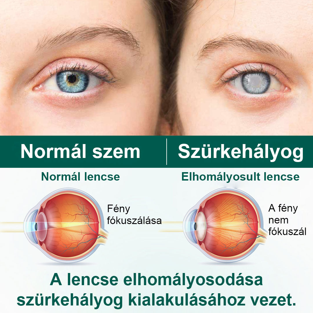 🫧CleraNaure® OptiClear Nano Szemgörgő Szérum
