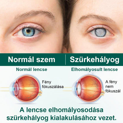 🫧CleraNaure® OptiClear Nano Szemgörgő Szérum