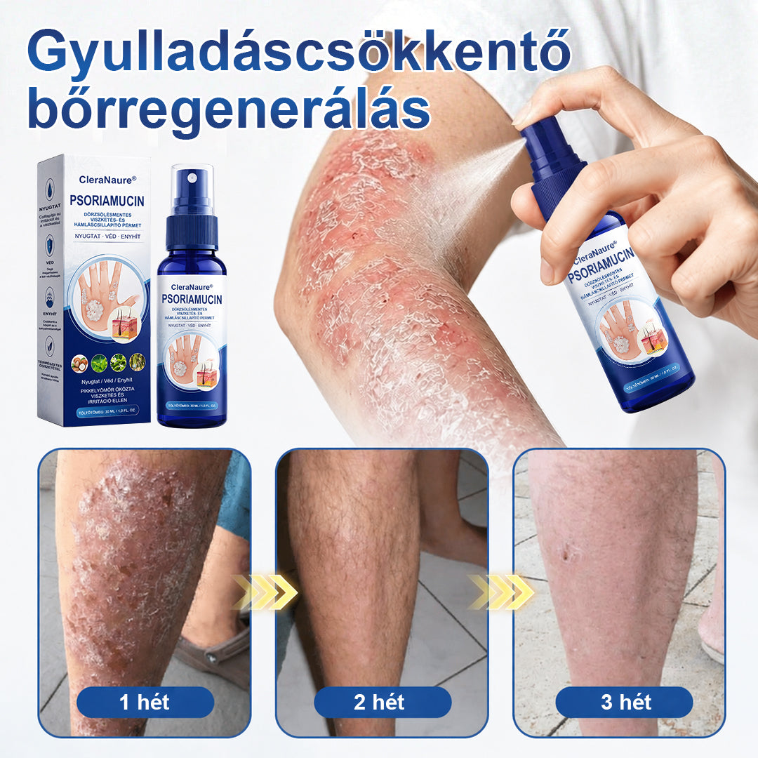🥇CleraNaure® PsoriaMucin Dörzsölésmentes Viszketés- és Pikkelyenyhítő Permet