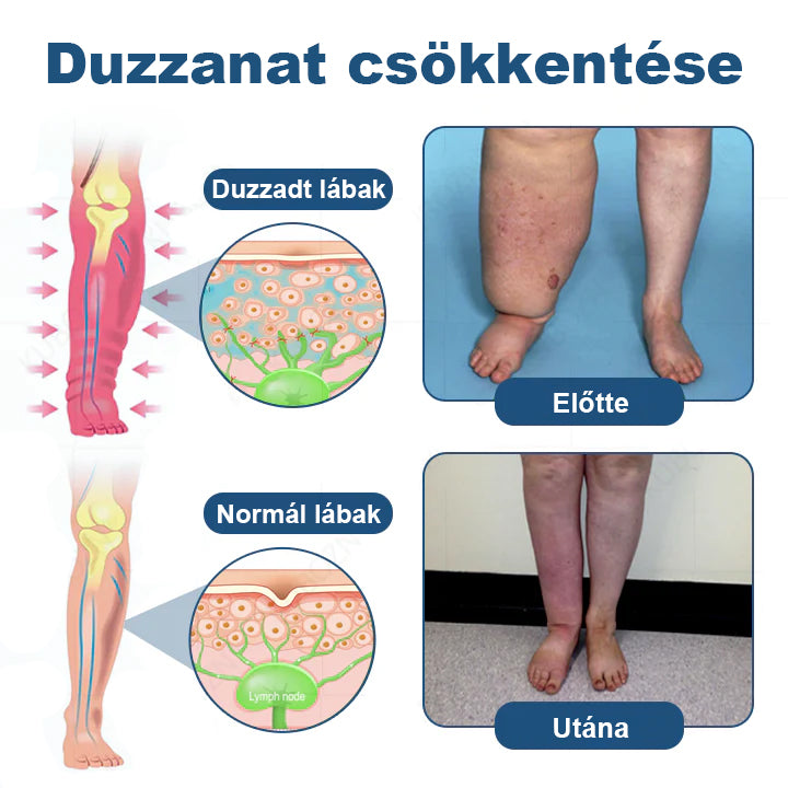 🥇CleraNature® Roll-On Pump Krém a Nyirokdrainázáshoz és Duzzanat Enyhítéséhez