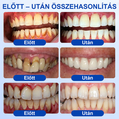 🍀CleraNaure® GumRevive – Fogágy-helyreállító Gél✨