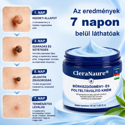 💎CleraNaure® 7 napos Bőrcímke- és Folttisztító Krém✨