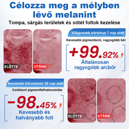 CleraNaure® GlowFade – Fényhozó és Folthalványító Arcmaszk