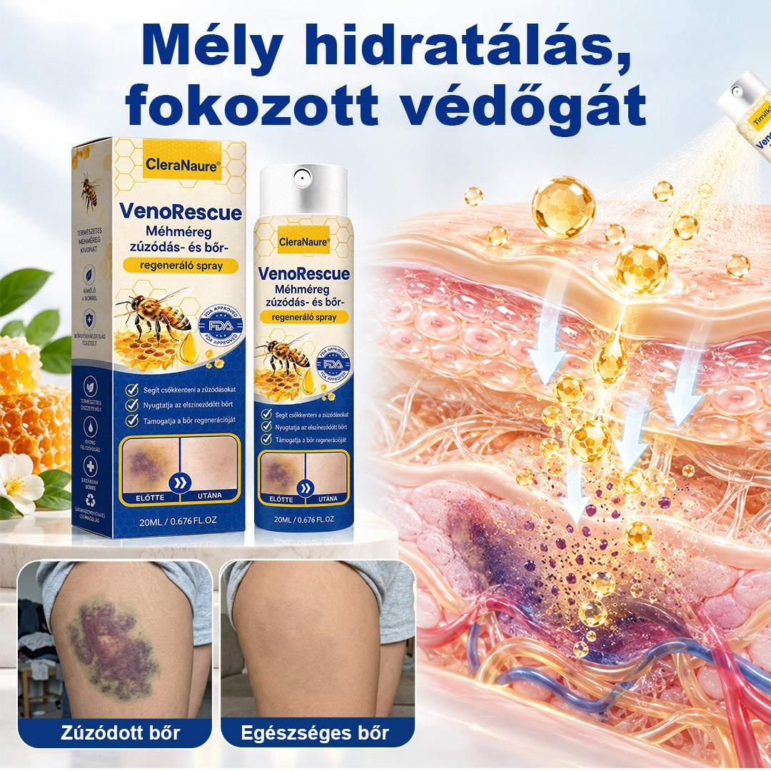 ✨CleraNaure® VenoRescue Méhméreg Zúzódás- és Bőrregeneráló Spray