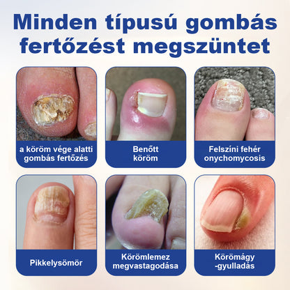 CleraNaure® FungiBee Fejlett Körömjavító Oldat