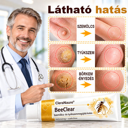 💧CleraNaure® BeeClear Szemölcs- és Tyúkszemmegújító Krém